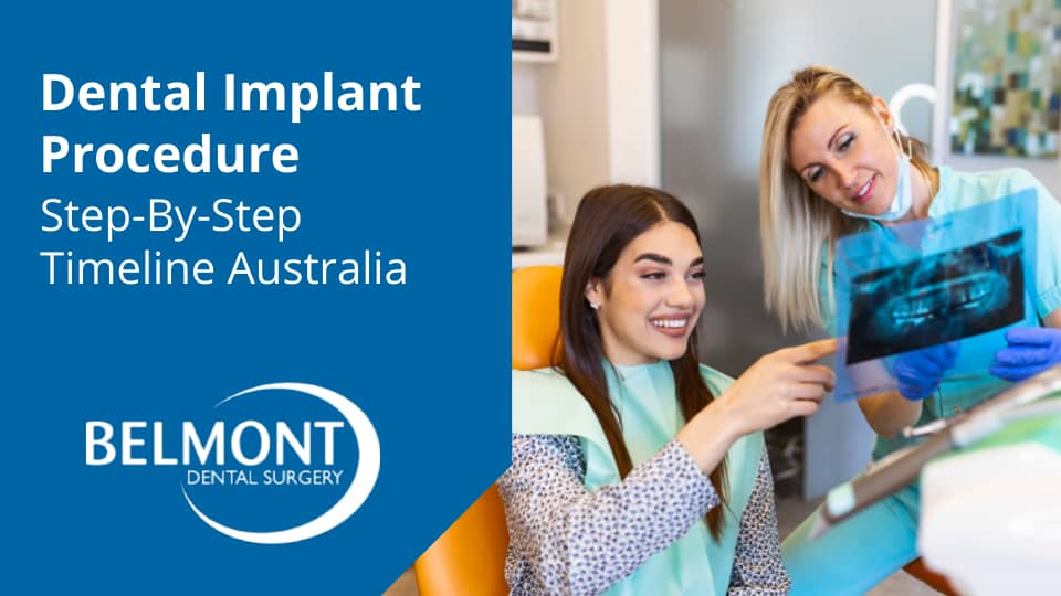 Dental Implant Procedure - Step-By-Step Timeline Australia