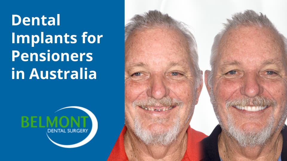 Dental Implants for Pensioners in Australia